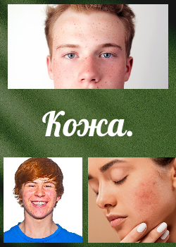 Кожные покровы.